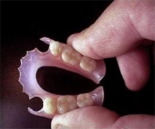 зубные нейлоновые протезы